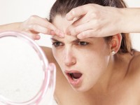 How to take care of acne-prone skin and seborrhoeic dermatitis?